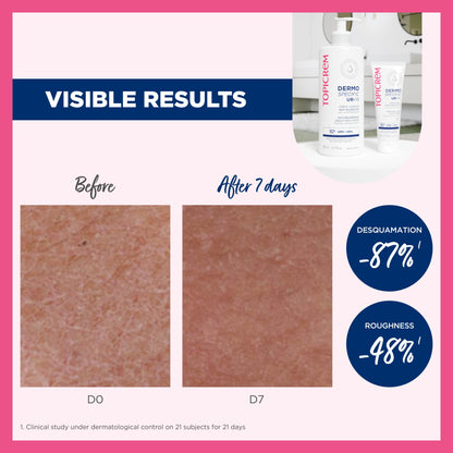 Topicrem DERMO SPECIFIC UR10 Anti-Roughness Smoothing Cream 200ml